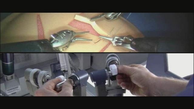 The Da Vinci Surgical System robot performing a minimally invasive surgical procedure with precision and control